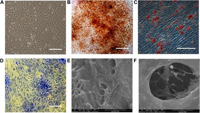 The treatment efficacy of bone tissue engineering strategy for repairing segmental bone defects under diabetic condition